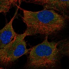 Anti-ST6GALNAC6 Antibody