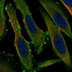 Anti-PACS1 Antibody