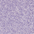 Anti-ASPG Antibody