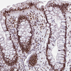 Anti-SRRM1 Antibody