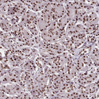 Anti-SRRM1 Antibody