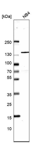 Anti-SRRM1 Antibody