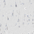 Anti-STK40 Antibody