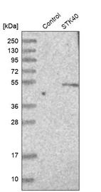 Anti-STK40 Antibody