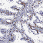 Anti-GPC1 Antibody