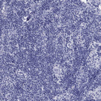 Anti-GPC1 Antibody