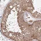 Immunohistochemical staining of human testis shows strong cytoplasmic positivity in cells in seminiferous ducts.