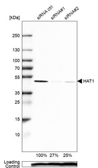 Anti-HAT1 Antibody