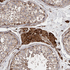 Anti-FLAD1 Antibody