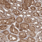 Anti-FLAD1 Antibody