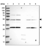 Anti-FLAD1 Antibody