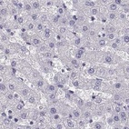 Immunohistochemical staining of human liver using Anti-MAGEB2 antibody HPA074544.