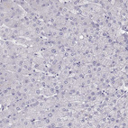 Anti-MAGEB2 Antibody