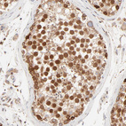 Anti-PARP12 Antibody