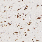 Anti-PARP12 Antibody