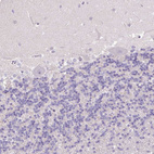 Immunohistochemical staining of human cerebellum shows no positivity in Purkinje cells as expected.