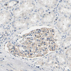 Anti-NFASC Antibody