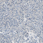 Anti-NFASC Antibody