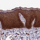 Anti-RPL17 Antibody