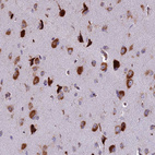 Anti-RPL17 Antibody