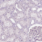 Anti-A4GNT Antibody