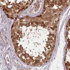 Anti-PCBP2 Antibody