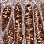 Anti-PCBP2 Antibody