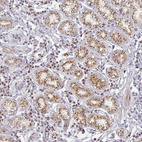 Immunohistochemical staining of human stomach shows moderate positivity in cytoplasm granular in glandular cells.