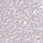 Immunohistochemical staining of human liver shows negative positivity in cytoplasm granular in hepatocytes.