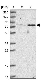 Lane 1: Marker [kDa] 230, 130, 95, 72, 56, 36, 28, 17, 11_br/_Lane 2: Human cell line RT-4_br/_Lane 3: Human cell line U-251MG sp