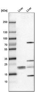 Anti-FKBP11 Antibody