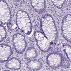 Anti-C11orf70 Antibody