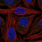 Anti-C11orf70 Antibody