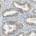 Anti-MAP3K4 Antibody