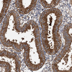 Anti-APEH Antibody