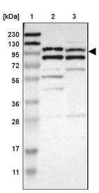 Anti-MAP3K21 Antibody