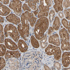 Anti-ALDH9A1 Antibody