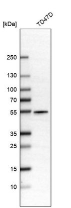 Anti-ALDH9A1 Antibody