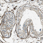 Anti-C1orf27 Antibody