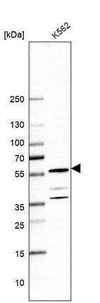 Anti-C1orf27 Antibody