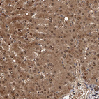 Anti-GMDS Antibody