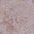 Anti-INTS4 Antibody