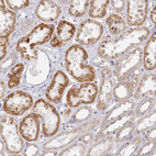 Anti-INTS4 Antibody