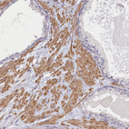 Anti-INTS4 Antibody