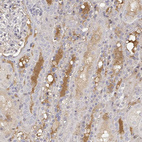 Anti-IGFBP4 Antibody