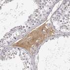 Anti-IGFBP4 Antibody