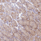 Anti-SSUH2 Antibody