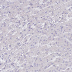 Anti-SSUH2 Antibody