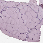 Anti-RCVRN Antibody