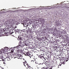 Anti-RCVRN Antibody